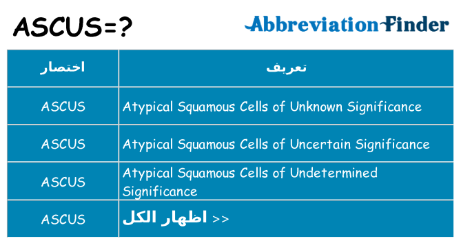 ماذا عن موقف % s
