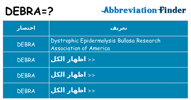 ماذا عن موقف % s