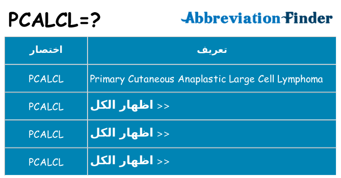 ماذا عن موقف % s