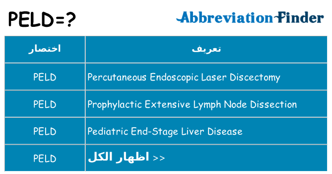 ماذا عن موقف % s