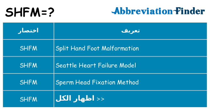 ماذا عن موقف % s