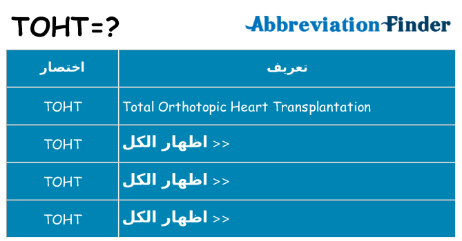 ماذا عن موقف % s