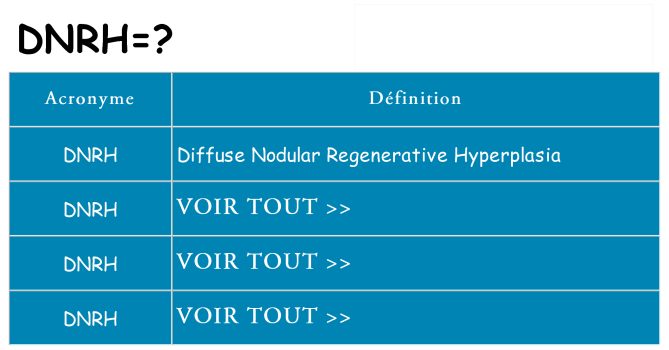 Ce que signifie le sigle pour dnrh