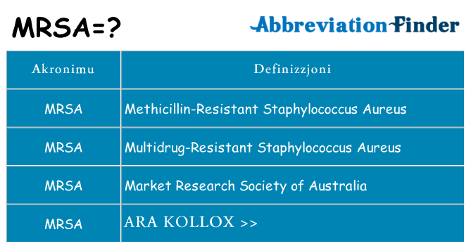 Dak ma mrsa joqgħod għal