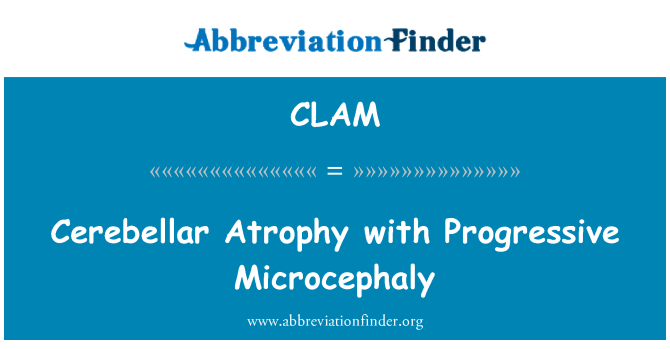 CLAM: ניוון אסטרוציטומה עם Microcephaly מתקדמת