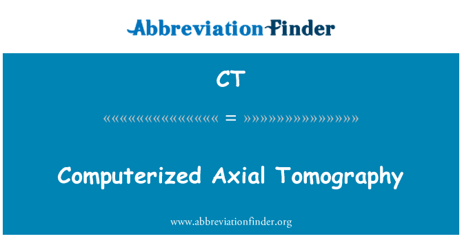 CT: Computerized Tomography aksial