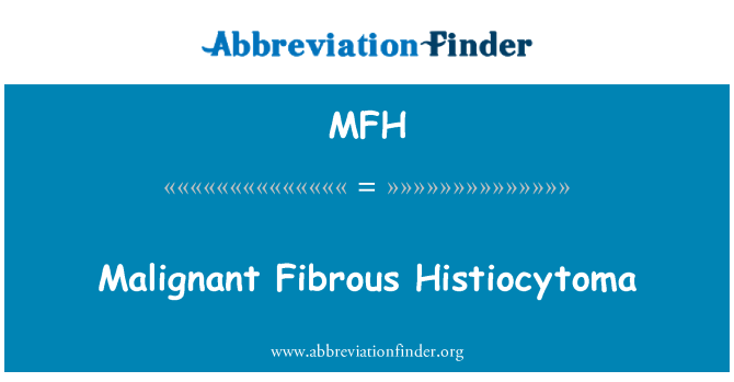 MFH: घातक तंतुमय Histiocytoma