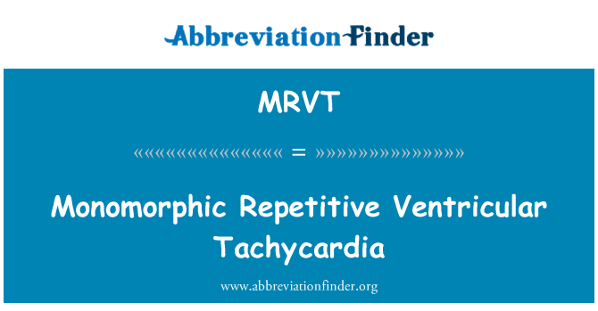 MRVT: Tachycardie ventriculaire monomorphe répétitive