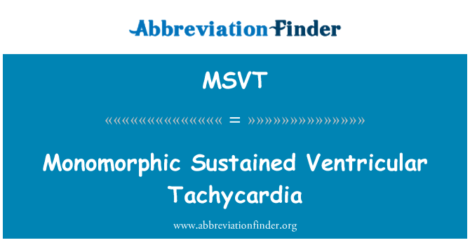 MSVT: Tachicardia ventricolare sostenuta monomorphic