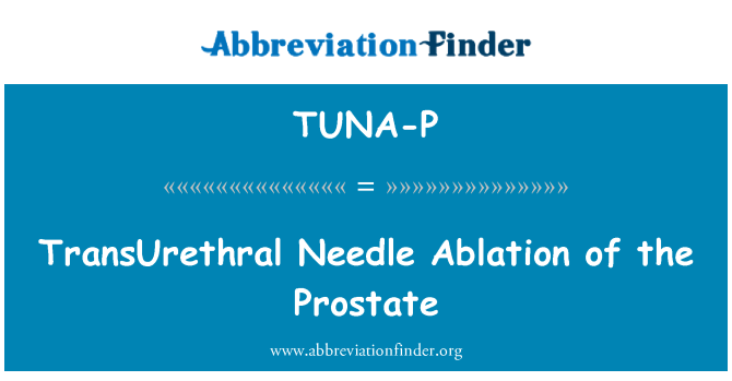 TUNA-P: تذرية الإبرة transUrethral البروستات